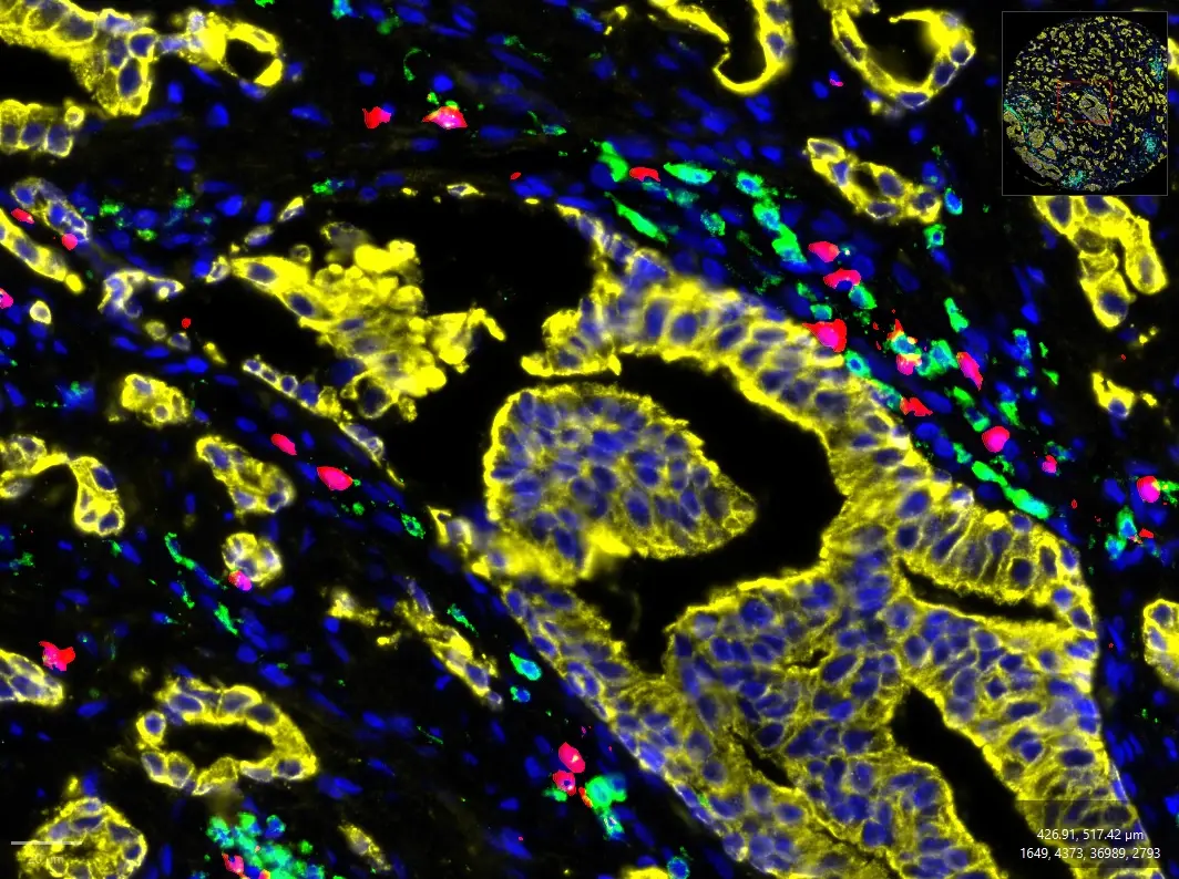 From Images to Insights: How to Quantify SignalStar® Multiplex IHC Data in QuPath