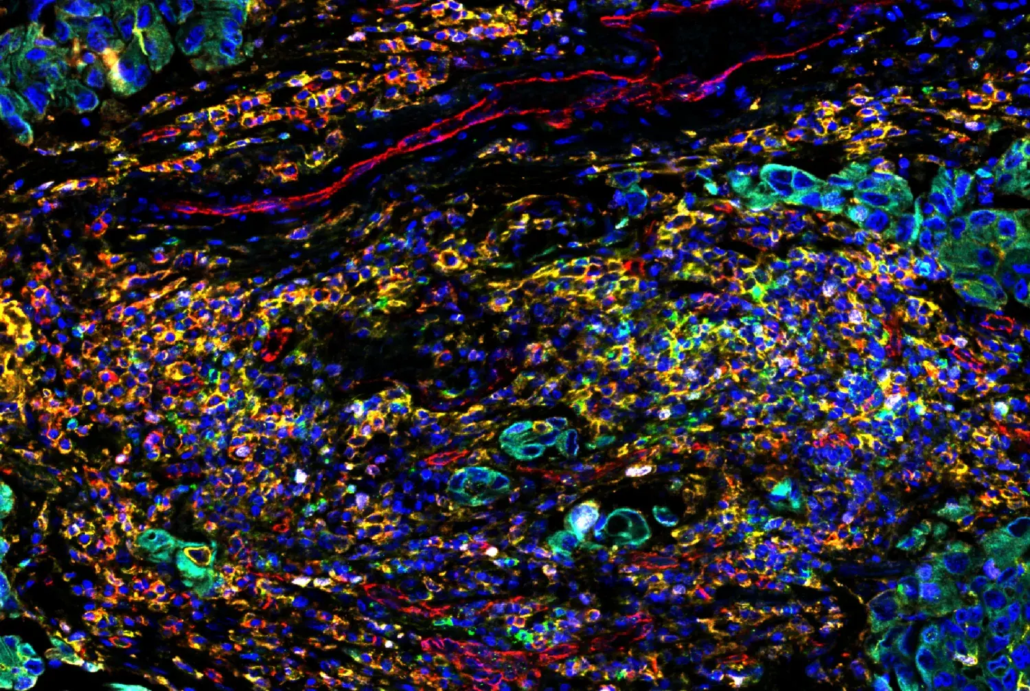 Unlock the Missing Marker: Three Ways to Expand Your Multiplex IHC Panel