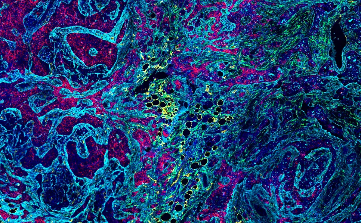 Quality Over Quantity: The Case for the Mid-Plex in Spatial Biology